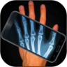 Xray Body Scanner 3.4